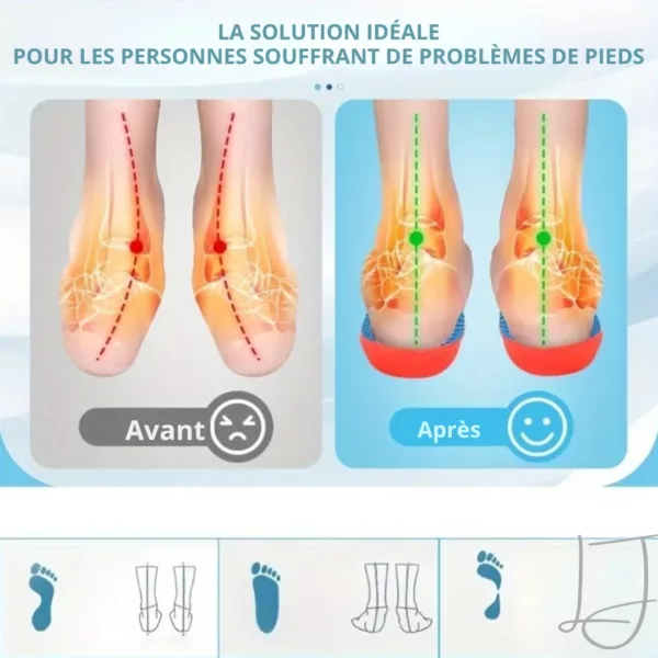 Semelle épine calcanéenne sport dynamique – Image 4