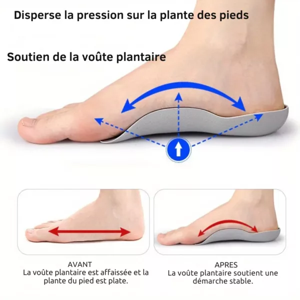 Semelle magnétique soutien voûte plantaire – soulage les douleurs, améliore la posture et la circulation – Image 3